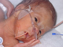 [2004.09.13HollandFirstCannulaAttempt.jpg]