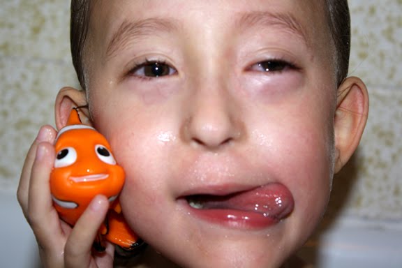 [2009.10.28HollandAllergies.jpg]