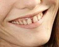 http://1.bp.blogspot.com/_UZ08fgn9FkE/TBhkgf5N-2I/AAAAAAAAAeg/WBe9_H3xKMI/s320/vanessa+paradis+teeth.jpg