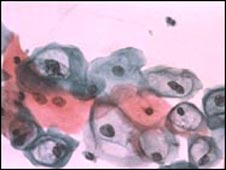 [SMEAR+(SİMİR)+TESTİ.jpg]