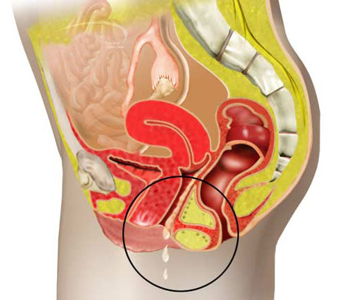 [KADINLARDA+MANTAR+HASTALIĞI.jpg]