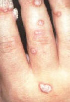 [SİĞİL+İÇİN+ŞİFALI+BİTKİLER.jpg]