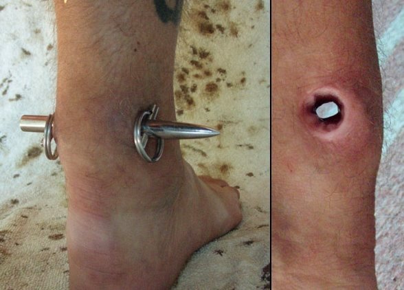 [mrtetanusachillespiercelp0.jpg]