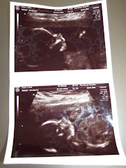 20 Week Scan