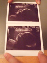 Scan at 28 weeks and 1 day
