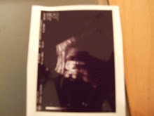 36 Week Scan