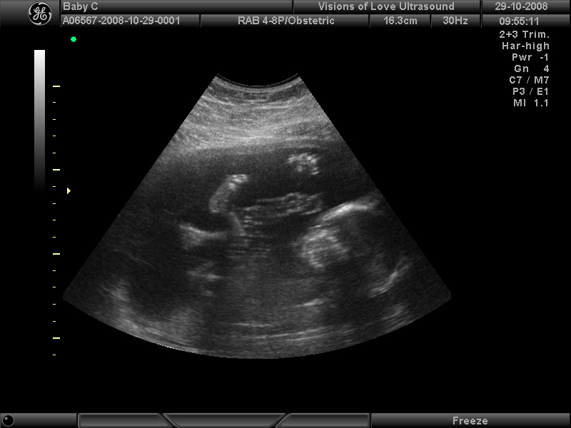 [Baby+picture7.jpg]