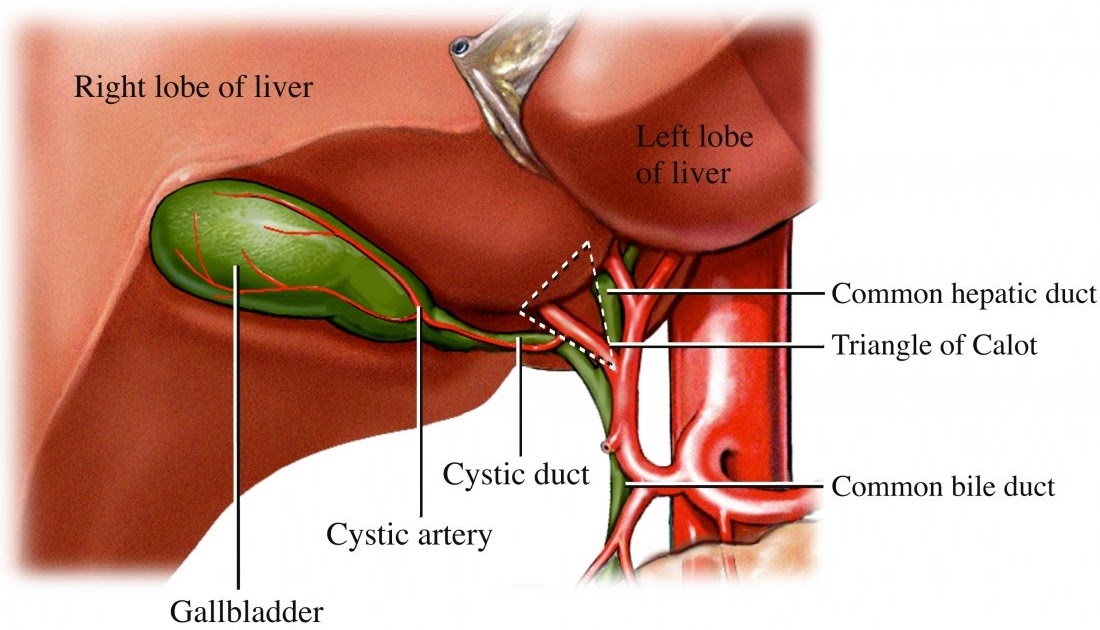 Medical Legal Demonstrative Evidence: Bile Duct Injury ... gall stone pain diagram 