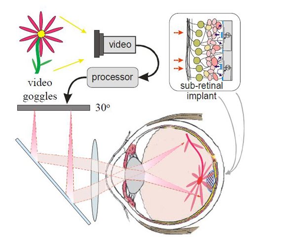 [nextgenretinas.jpg]