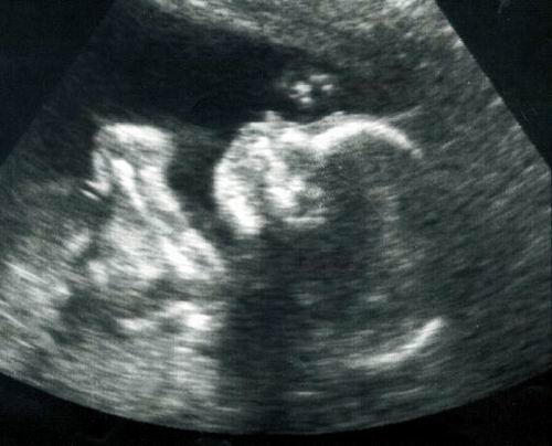 [ecografia01.jpg]