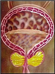 prostatite guarita con serenoa