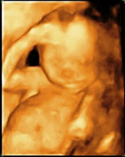 Our Baby Girl at 18 wks (5.5 inches long)