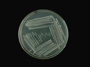 Staphylococcus aureus in Nutrient Agar
