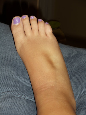 fat Pictures feet of