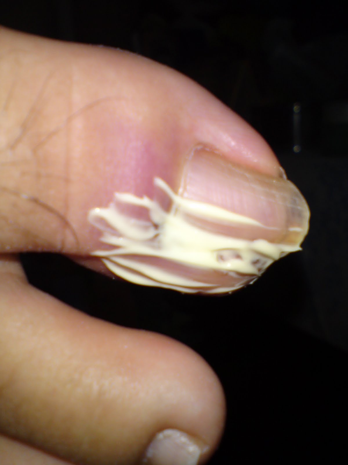 Special Love, Joy & Passion!: Day 16 of Hols: Changing of Toe Wound ...