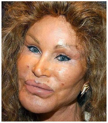 angelina jolie plastic surgery nose. Bad Plastic Surgery: