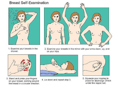 Clinical Breast Exam