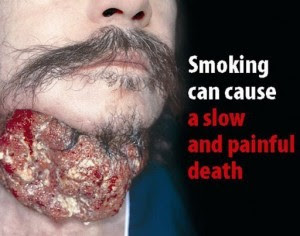new-graphic-health-warnings-cigarette-packs-300x236.jpg