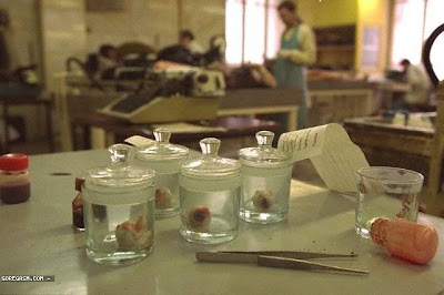 Pabrik Penjual Organ Tubuh Manusia di Rusia!