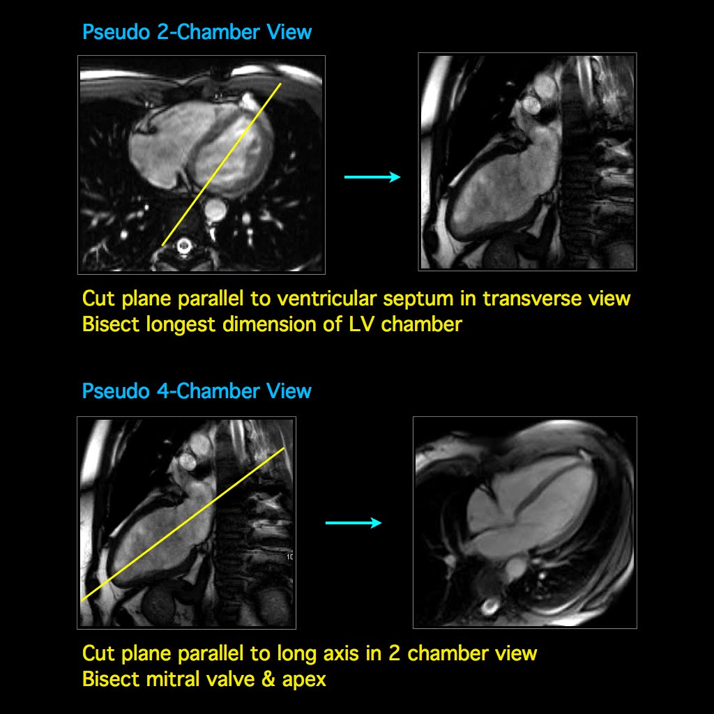 pdf computational biomechanics for medicine from algorithms to models