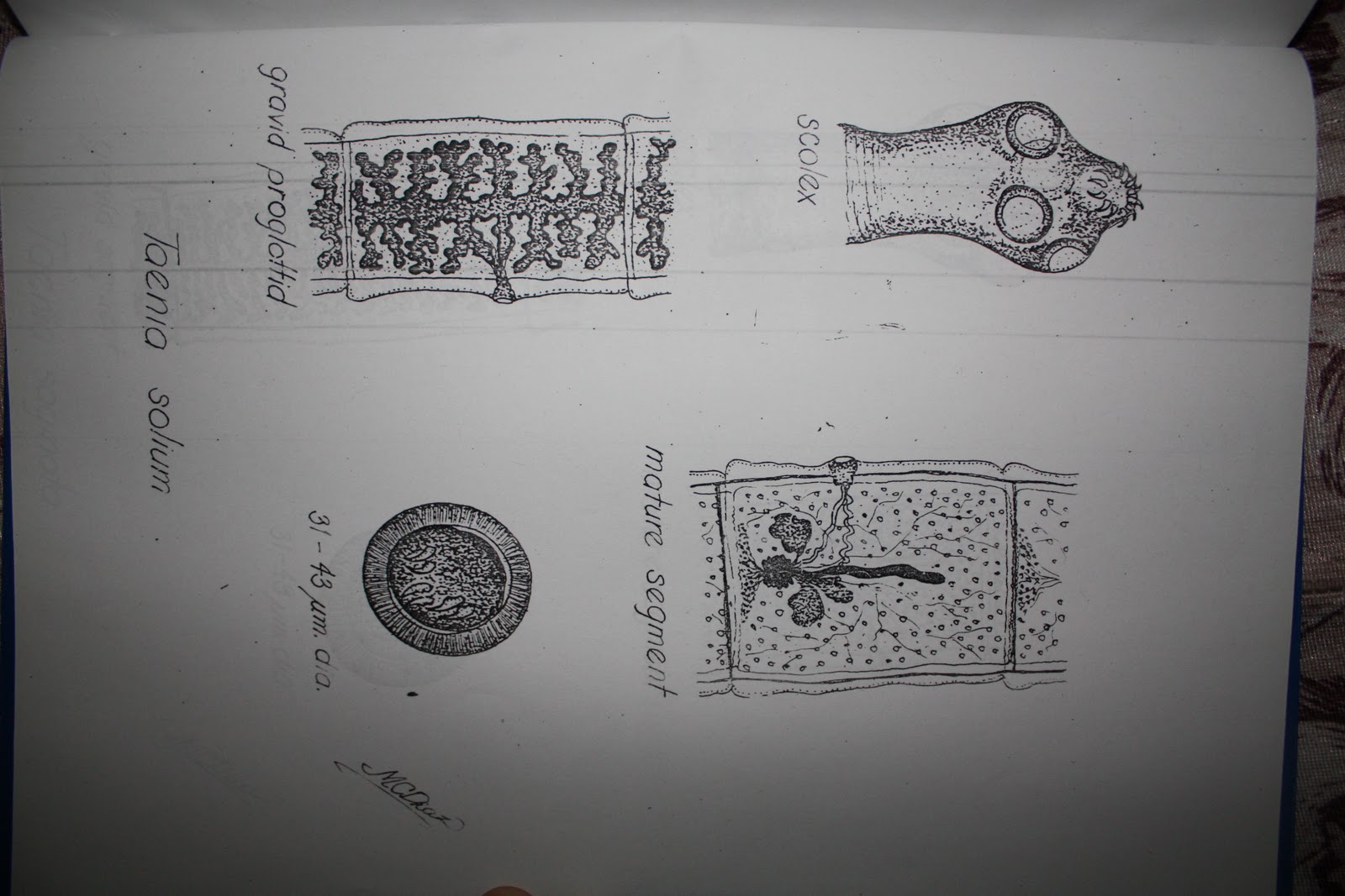 MD Files: Medically Important Parasites [Sketch by Dr. Macario Diaz]
