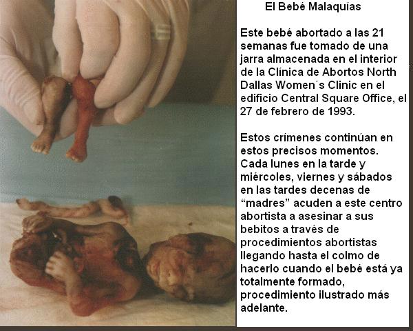 [aborto15.jpg]