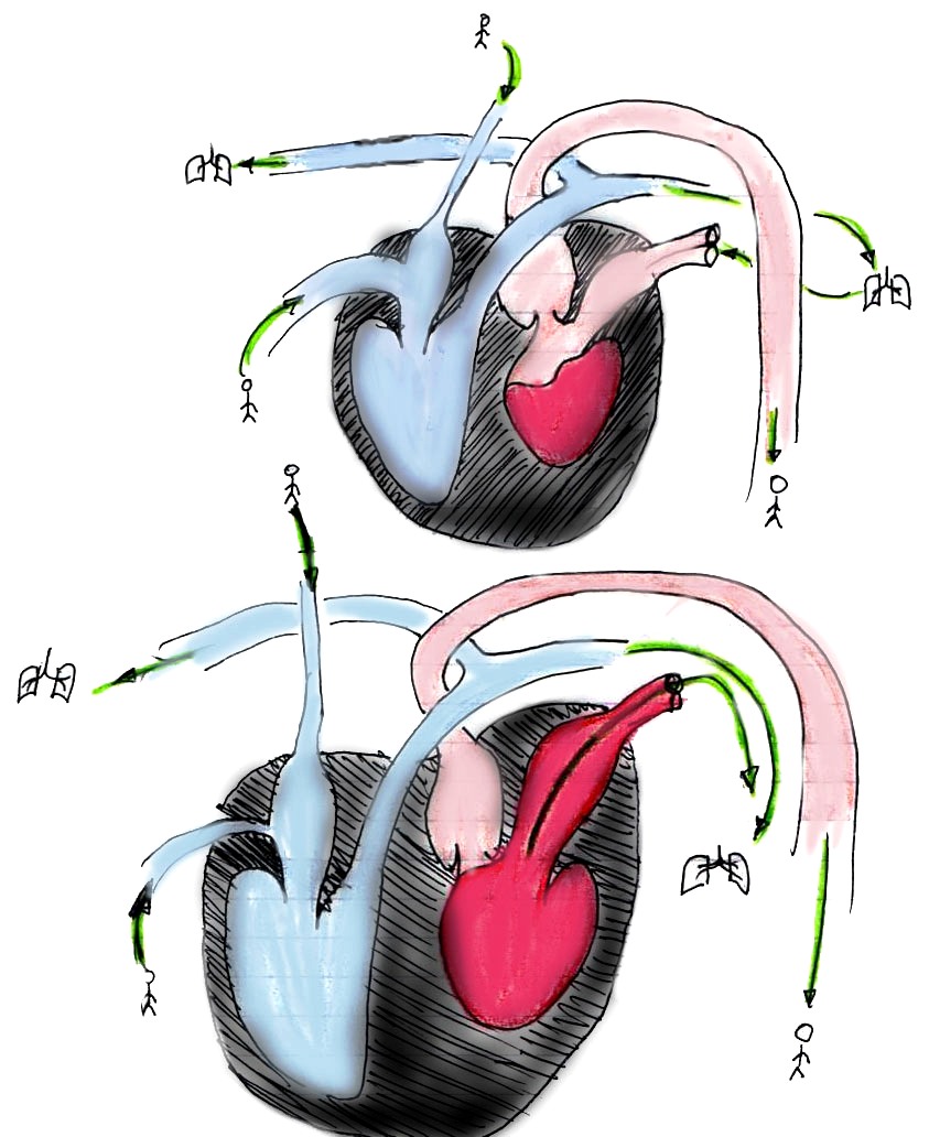 RR Content: The Circulatory System
