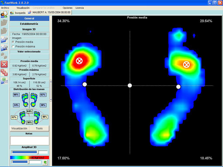 [analisis+de+presion+plantar.jpg]