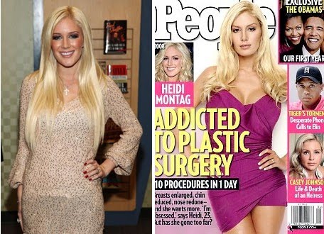 heidi montag plastic surgery before and after pictures. heidi montag before and after