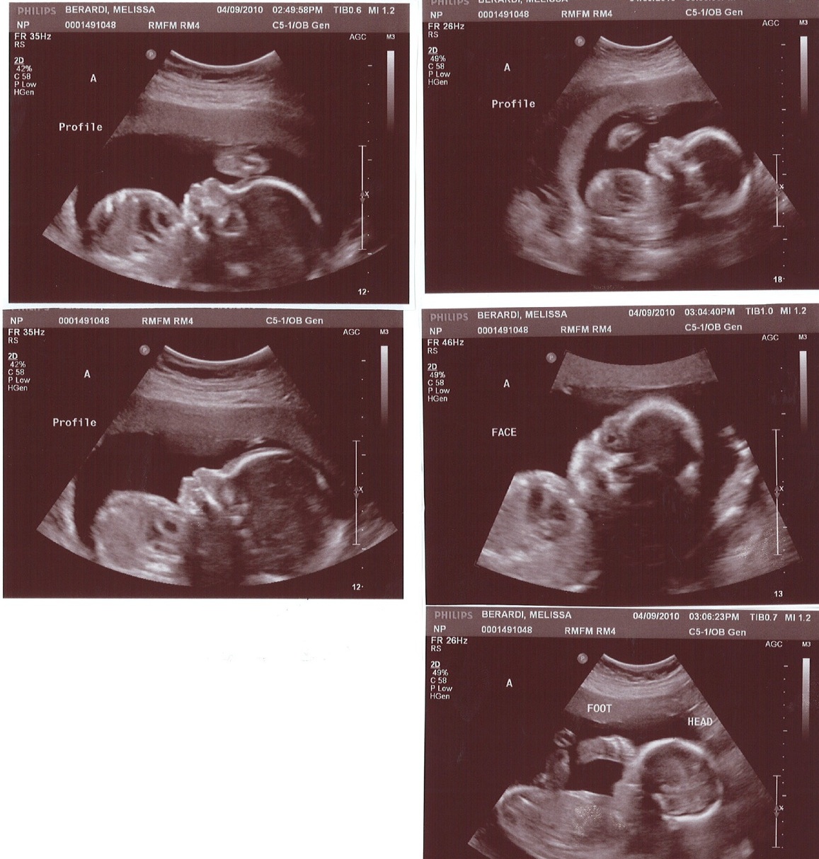 810 House and Garden 24 Week Ultrasounds