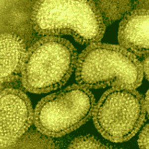 [flu-virus.jpg]