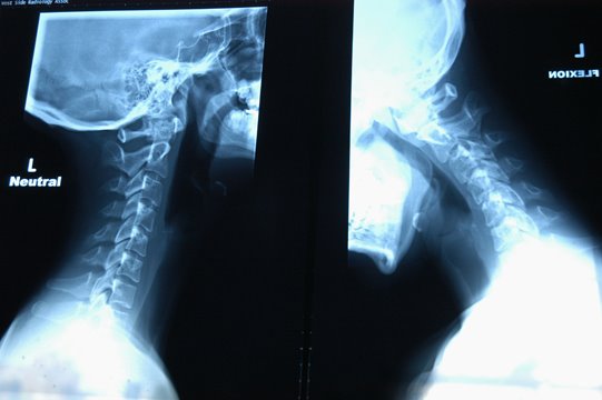 [xray2sm.jpg]