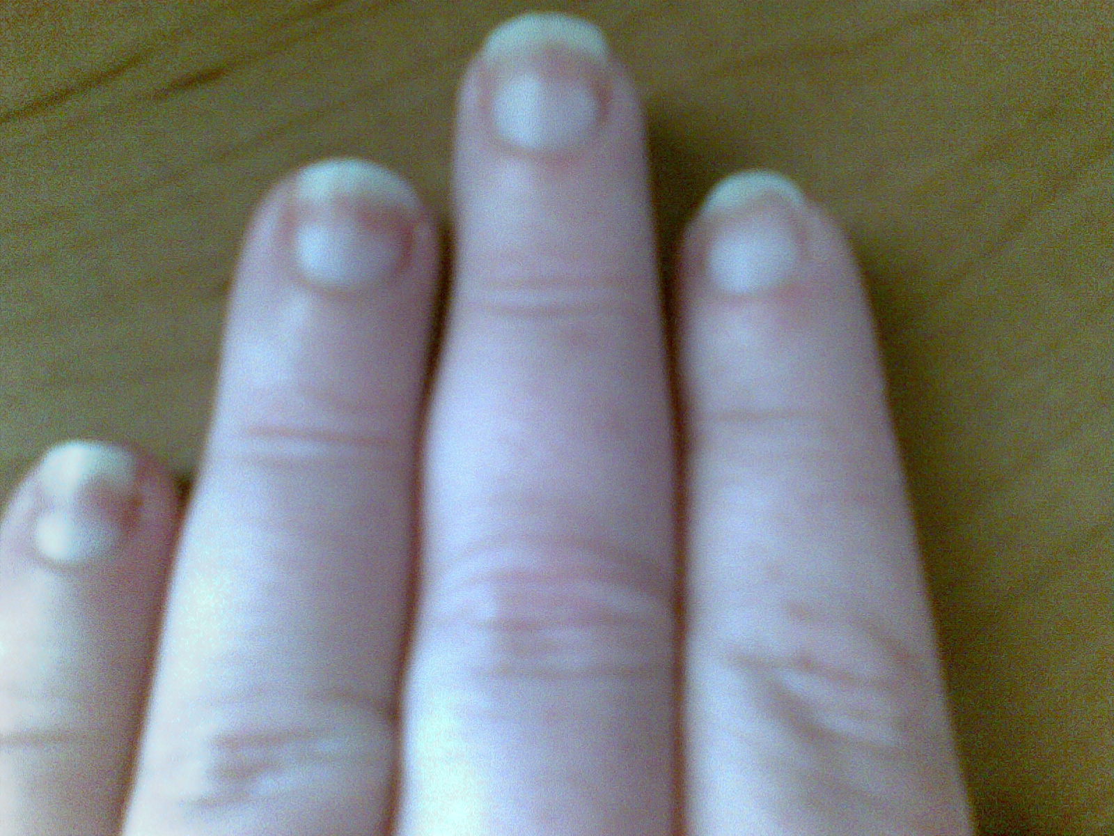 Melinda S Blog 5 25 10 See How The Pink Part Of My Nails Is Turning White Crawling Up A Little Every Week If You Google Nail Beds Get Heart Or