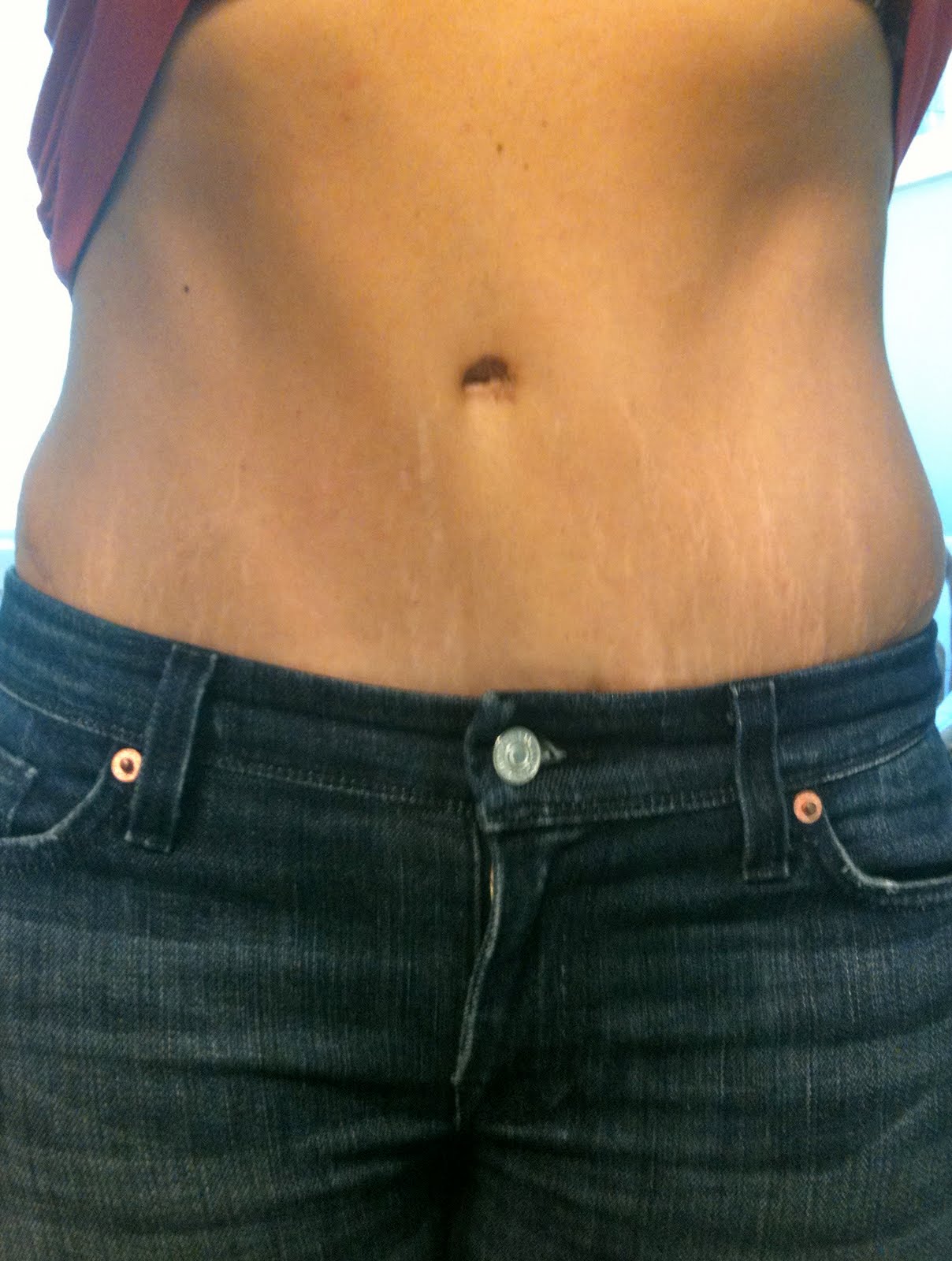 Mama Rocks Tummy Tuck 1 Year Anniversary Pics!