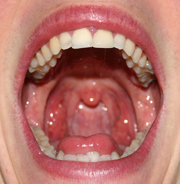 ultra-gross-mouths-disgusting-any-way-you-look-at-them