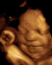 A tecnologia avança a cada dia