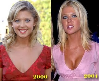 http://1.bp.blogspot.com/_bQ0SqifjNcg/SpOHNJobn2I/AAAAAAAAC88/XTYAmGkB4_A/s1600/tara-before-and-after.jpg