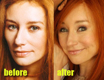 tori-amos-plastic-surgery-2.jpg