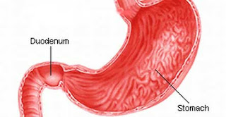 How is gastritis revealed