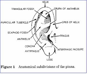 My Words Otitis Eksterna Nekrotikans
