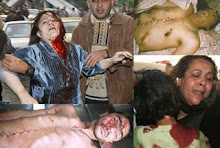 foto-foto kedurjanaan Israel terhadap umat Islam