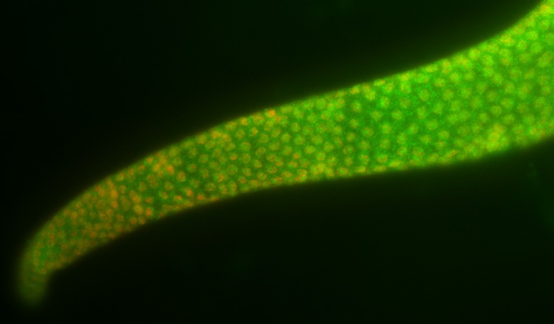 [KDM1+gonad+expression.jpg]