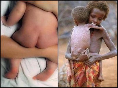 [fome[1][1].JPG"><img]