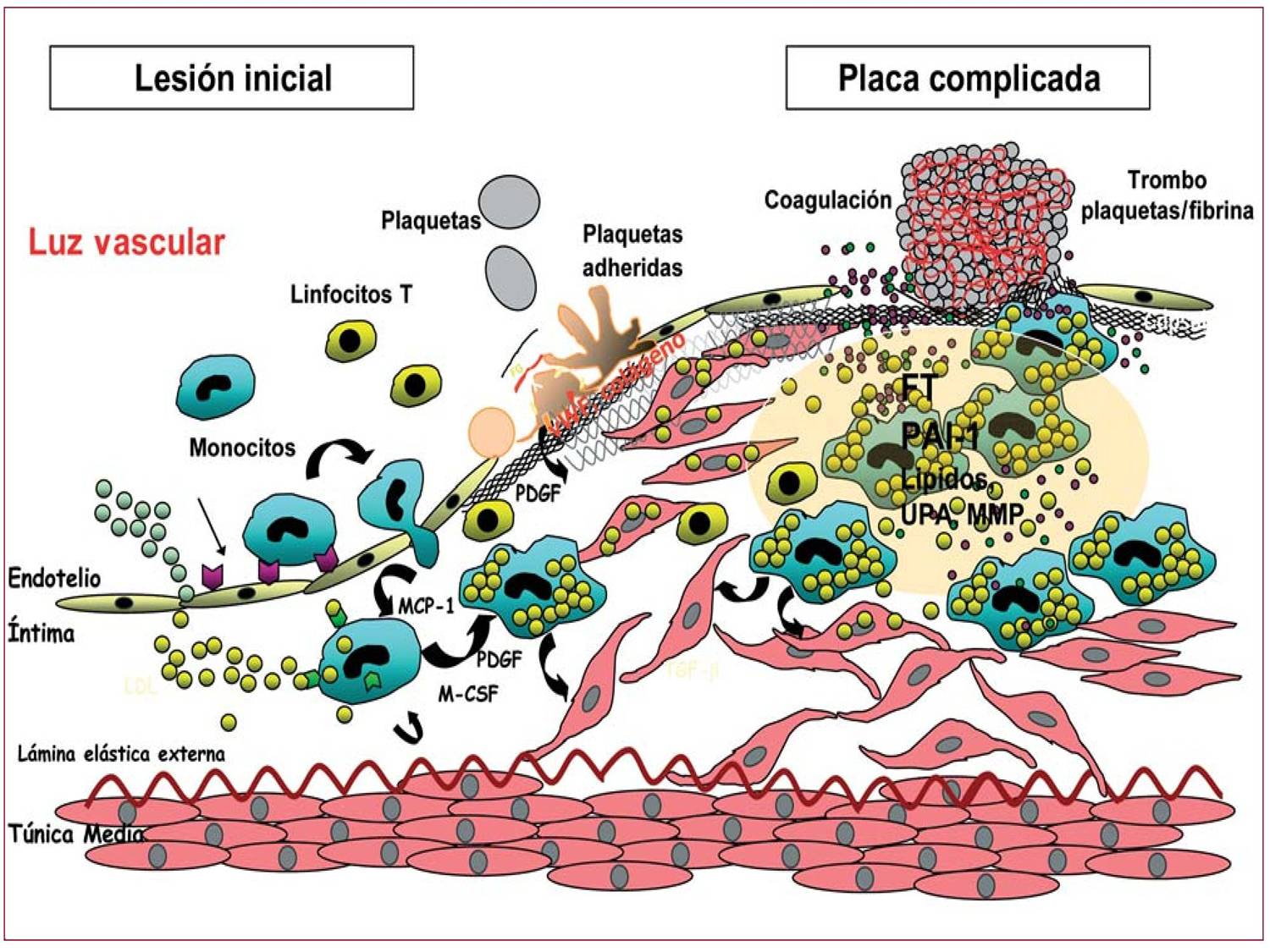 EL ENDOTELIO NORMAL ES UNA