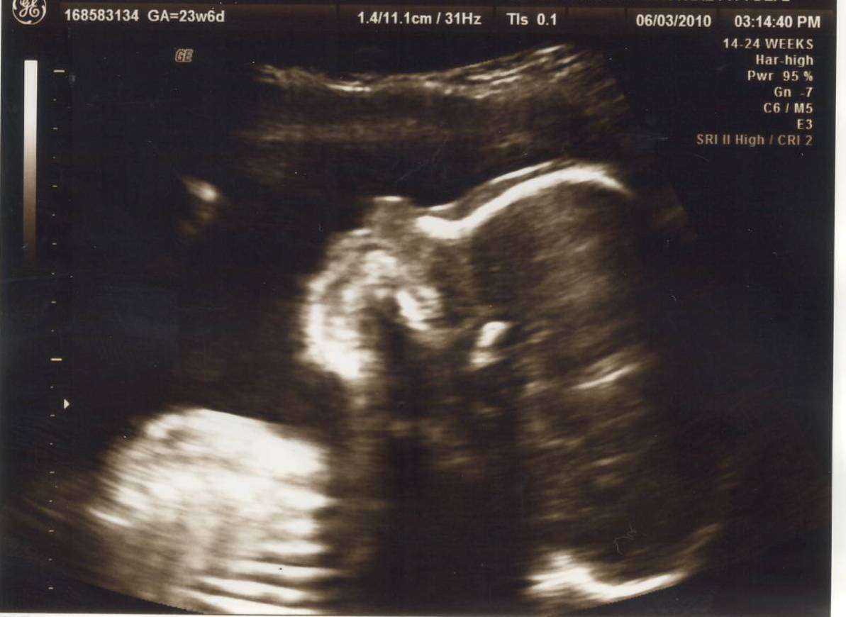 A RAINBOW ON THE HORIZON: 24 Week Update