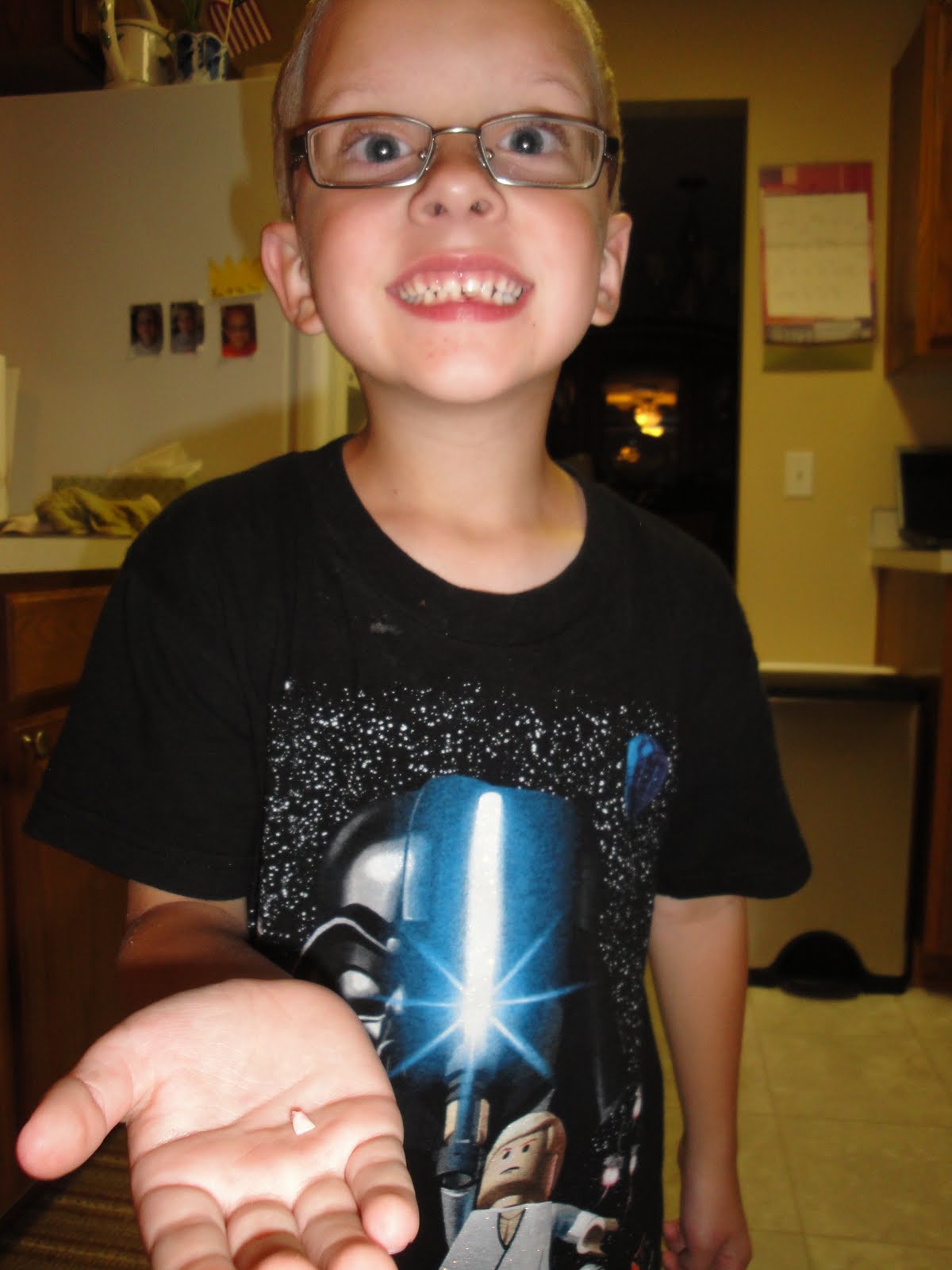 Katrina Tripled: Josh Lost a Tooth