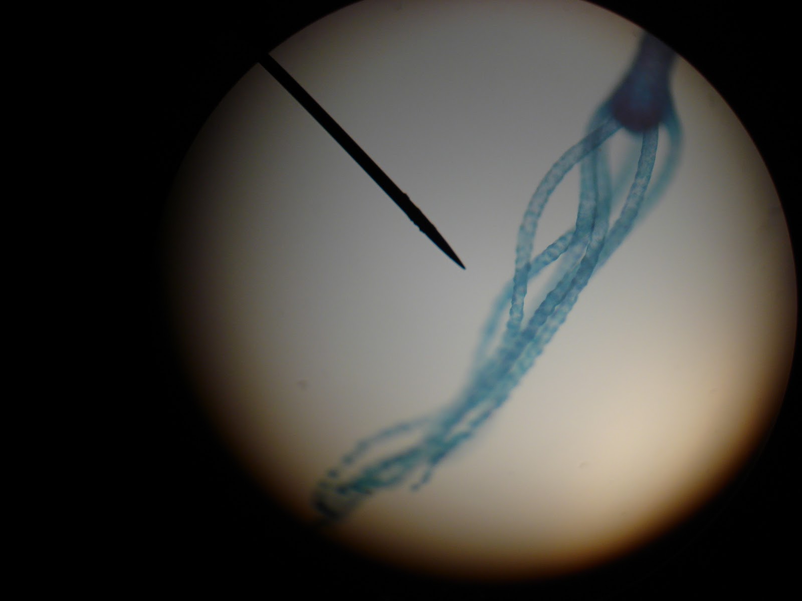 Rebekah's Dissection Log: Hydra: Phylum Cnideria