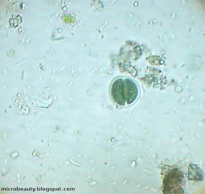 Microorganism.
