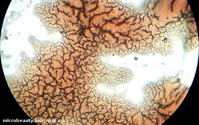 Dry Blood. Magnification 100 Times.