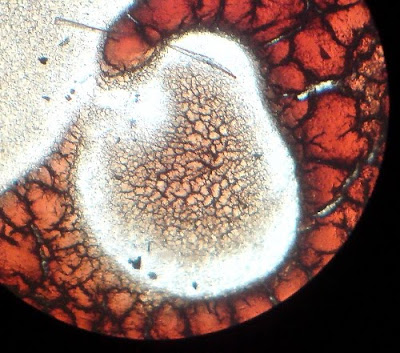 Dry Blood. Magnification 100 Times.